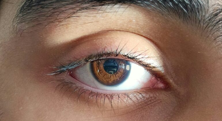 wanneer make up na ooglidcorrectie
